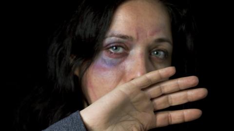 Stock photo of injured woman defending herself (Picture posed by model)