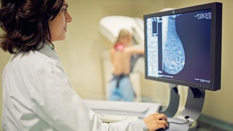 A mammogram being carried out to screen for breast cancer