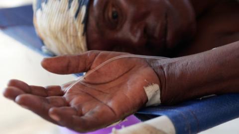 A cholera-stricken patient is pictured at Benguela hospital in Angola in 2007