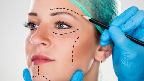 A close up of a woman's face as a surgeon draws perforation lines on her ahead of a facelift.