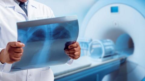 Man holding a scanned image of a skeletal chest in front of an MRI scanner