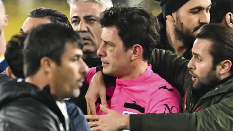 Referee Halil Umut Meler's face swells after Faruk Koca, President of MKE Ankaragucu throws a punch to him following the Turkish Super Lig week 15 football match between MKE Ankaragucu and Rizespor at Eryaman Stadium in Ankara