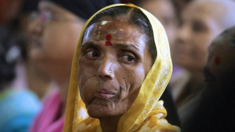 Indian cancer affected woman attends an International Women's Day celebration for patients of the Cancer Patients Aids Association in Mumbai, 08 March 2006.