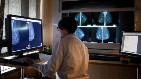 Radiologist looks at the results of mammograms.