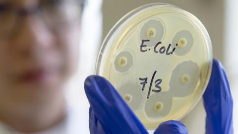 Scientist with an E. coli sample