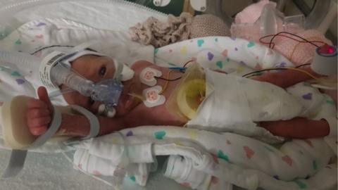 Baby Lacey in hospital