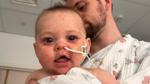 Image showing baby Margot with a breathing tube being held by her father