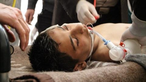 A Syrian victim receives treatment after an alleged chemical attack at a field hospital in Saraqib