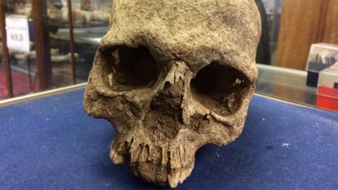 Anglo-Saxon skull