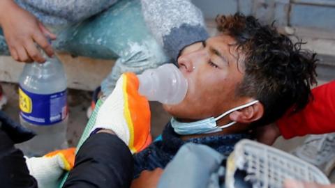 Young man lying on the floor with an oxygen mask over his mouth