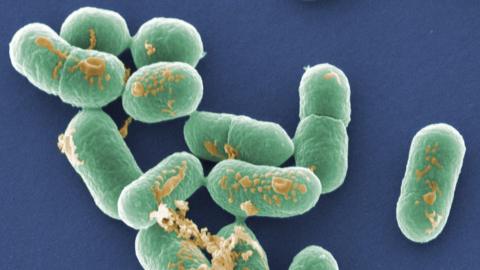 Coloured scanning electron micrograph (SEM) of Listeria monocytogenes bacteria