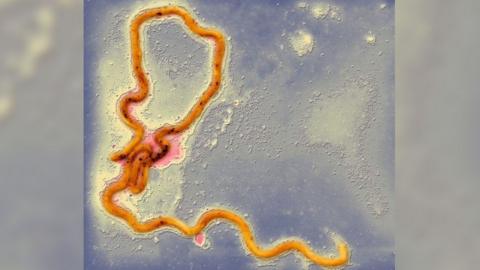 Syphilis bacterium