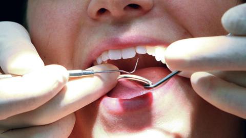 The hands of a dentist working inside someone's mouth. They have white teeth.