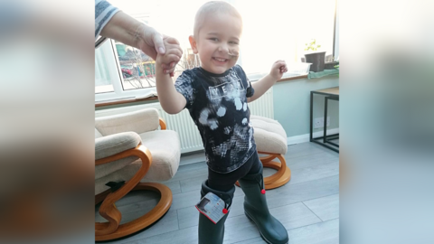 A two-year-old boy with a medical tube up his nose smiles in wellies that are too big for him. 