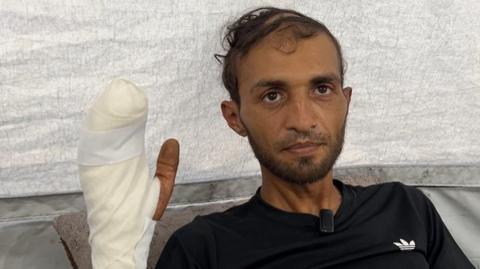 Mohammed al-Qedra holds up his injured hand while lying on a bed at the UK-Med field hospital in al-Mawasi, southern Gaza