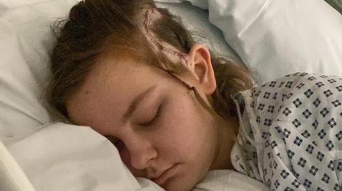 Tilly, lies on a hospital bed sleeping. There is a distinctive scar with stitching on the left side of her head.