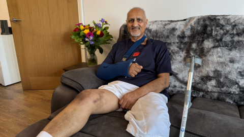 A man with short grey hair and a beard sitting on a dark grey sofa with a dark blue shirt and one bare leg up on a stool with a silver crutch beside him