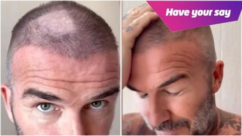 David Beckham reveals he has accidentally shaved a patch of hair off.