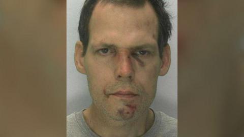 Custody picture of Woodley, who is wearing a grey t-shirt and has dark hair. He has a number of cuts and grazes on his face, including under one eye, the side of his mouth and on his chin. 