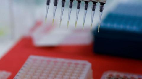 An employee dilutes poultry serum samples for a test for the detection of antibodies to the avian influenza virus in brazil in 2023.
The image shows pipettes containing a yellow liquid help over a tray of samples.
