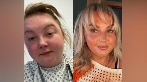 Two pictures of Holly Dyson alongside each other. She is pictured in a hospital robe in one and wearing a white and orange jumper and smiling at the camera in the second.