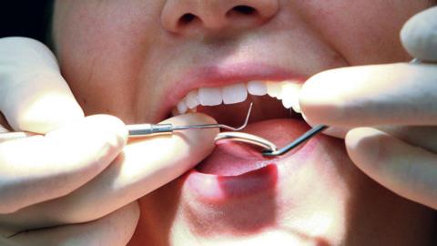 An open mouth being examined by a dentist's hands which are holding a mouth mirror and a ds. He is holding a mirror and a sickle probe,