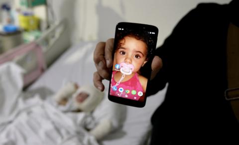 A man holds a phone with an image of a little girl on it, while she lies behind him in a hospital bed