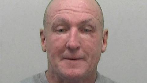 Mugshot of Downey. He is clean shaven with a shaved head and has scars and marks across his red face.