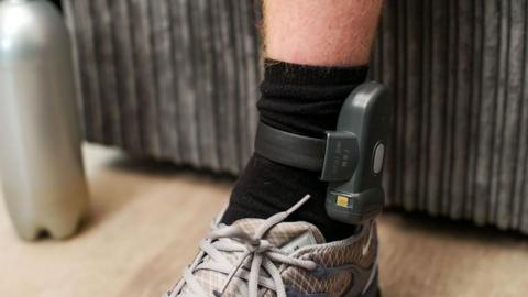 A view of a person with an ankle tag.