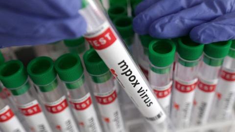 A close-up of test tubes in a rack, labelled "mpox virus". One is being held up by a person wearing blue surgical gloves