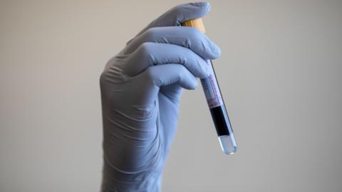 A person's hand -wearing a blue latex glove - holding a tube with blood sample 