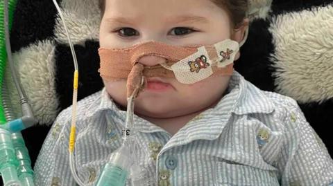 Ayden Braqi with a medical ventilation system attached to his nose and face. He wears blue, striped pyjamas with teddy bears on.