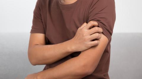 A man scratching his upper arm (stock image)