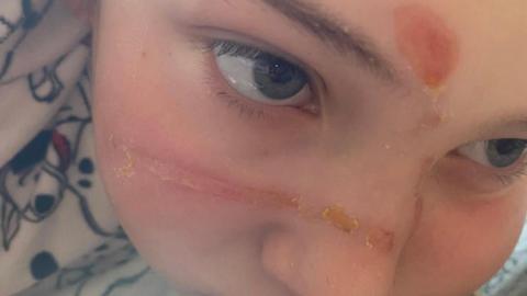 Bella with a wound on her forehead and across her nose. She is looking away from the camera
