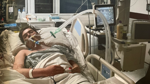 The image shows a patient lying in a hospital bed in an intensive care setting, connected to a ventilator via a breathing tube. Multiple tubes, wires and monitoring leads are attached to his body, with a pulse monitoring device on a finger.