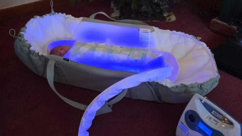 Baby sleeping in a portable bed in one of the special sleeping bags which is attached by a machine via a tube covered in material. The bag is lit up blue