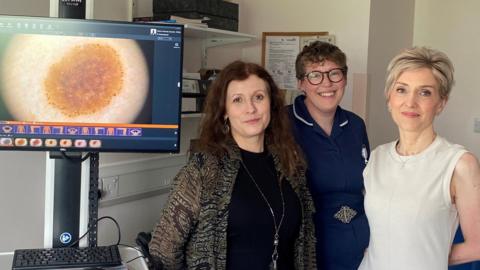 On the left is a monitor that has a zoomed in picture of a mole. On the right are three people standing looking towards the camera. They are standing in a small white room.