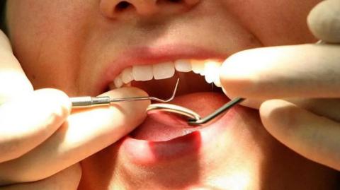 A close-up image of dental tools, including a mirror, being used to examine someone's teeth.