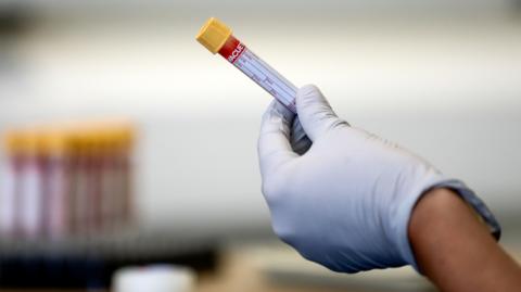 A gloved hand holds a test tube containing a blood sample