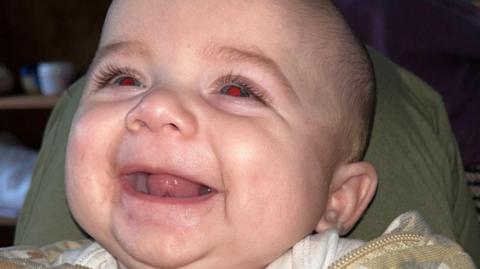Jensen-Lee laughing in a close up shot. His mouth is open as he smiles. His head is resting on a green pillow. 