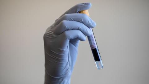 A paramedic holding a test tube containing a blood sample.