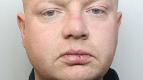 A close-up of a man's face. He has cracked lips, and is looking directly at the camera. He is wearing a dark top. 