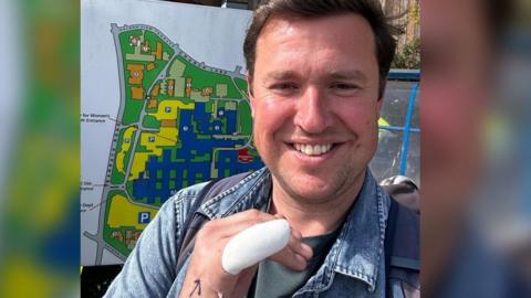 Steve Race is smiling at the camera. He has his finger bandaged and is standing outside a hospital
