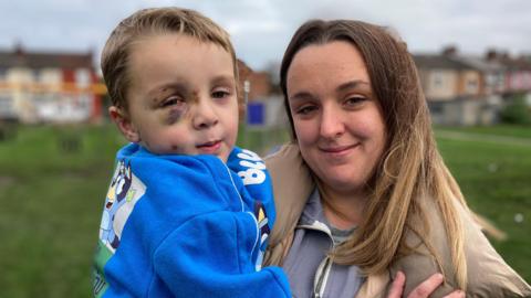 Roman on the left and Joanne on the right. They are both looking at the camera. Roman is wearing a blue top. Bruising and scars around Roman's right eye from the dog attack are visible. Joanne is wearing a grey top and light brown jacket.