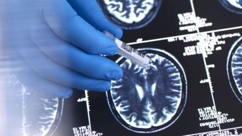 A blue gloved hand holds a test tube with a barcode on in front of a screen showing brain scan images