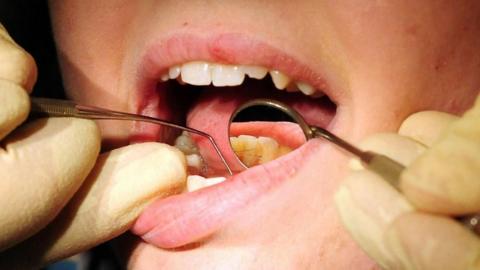 A person's mouth is open. A person wearing rubber yellow gloves is using dental tools to do a check-up of their teeth. 