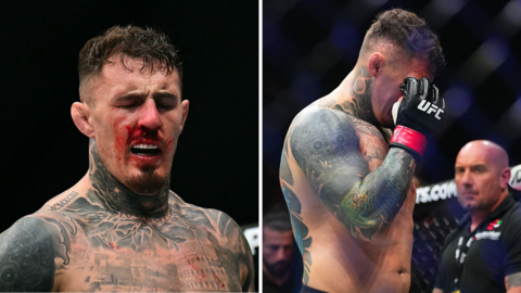 Tom Aspinall suffering from an eye poke