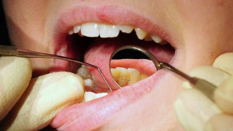 Patient undergoing dental check up