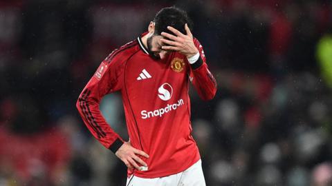 Bruno Fernandes with his hand on his head