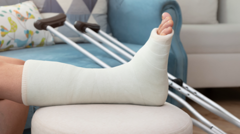 A leg in a cast is seen lying across a bed with cutches propped in the background